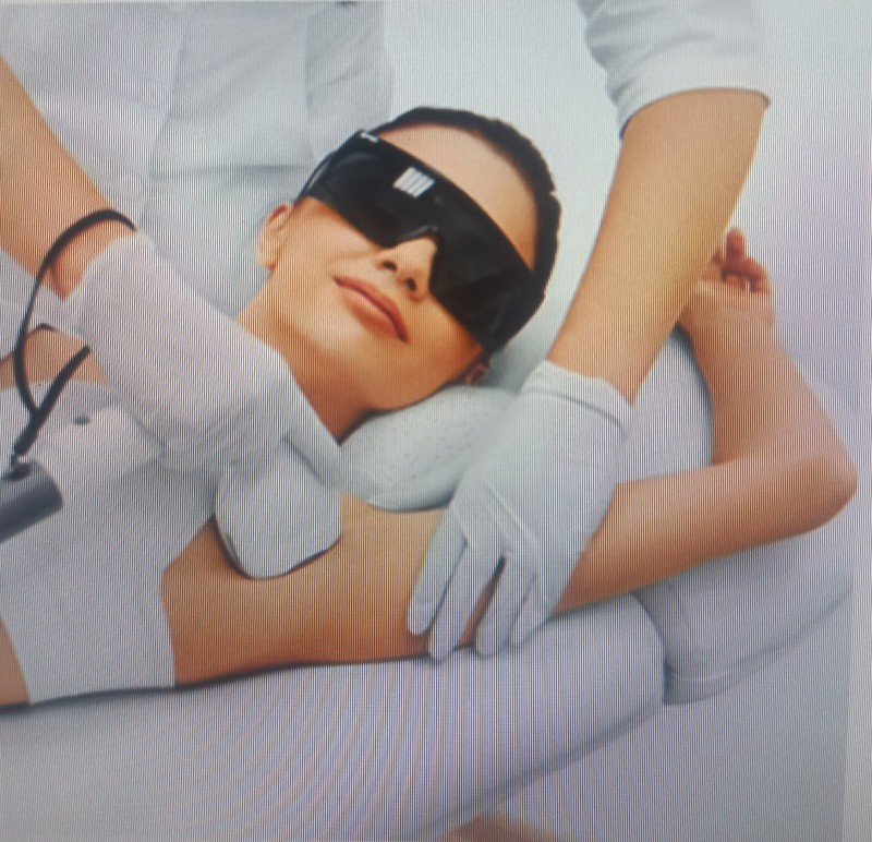 cabinet d'esthétique pour épilation définitive à la lumière pulsée sur Nîmes centre-ville