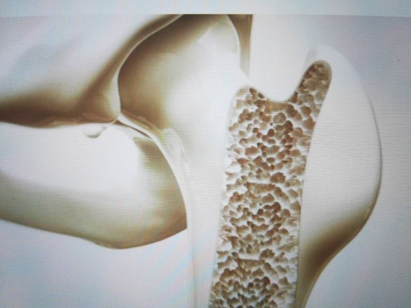 Où trouver un chirurgien pour intervention chirurgicale des ligaments croisés sur Montpellier proche de Sète